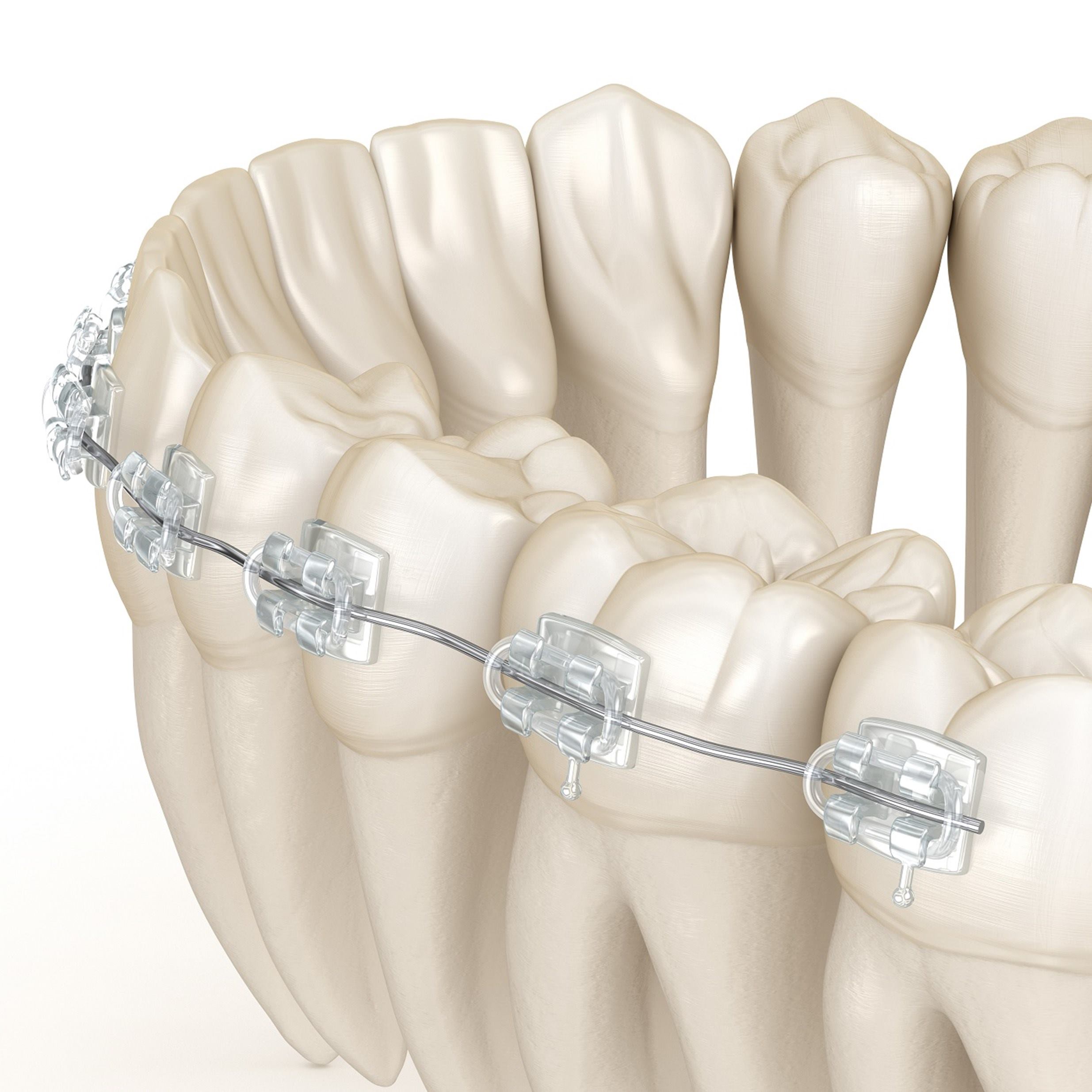 odontologia_tratamiento_dientes-ortodoncia_muelas