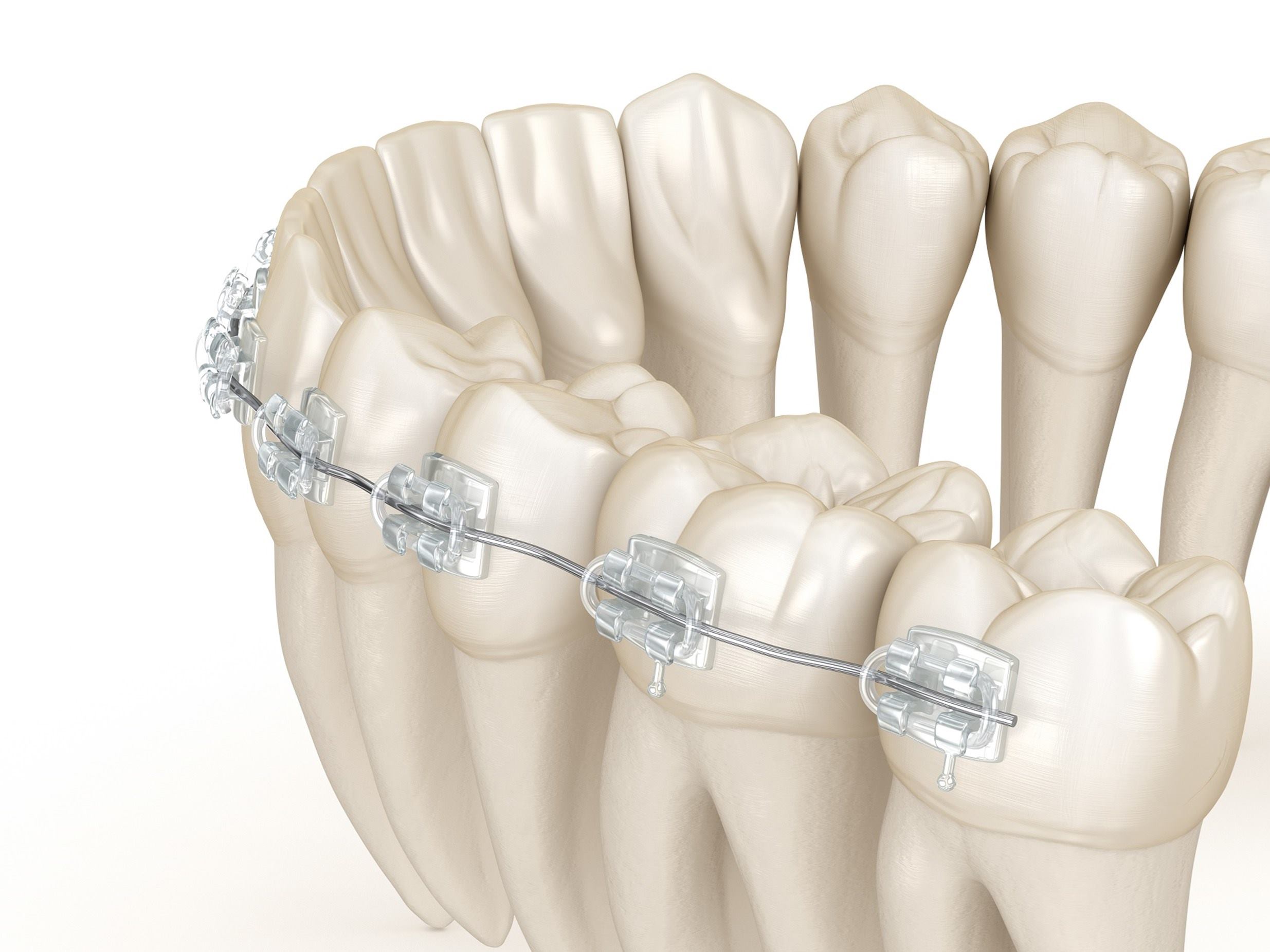 odontologia_tratamiento_dientes-ortodoncia_muelas